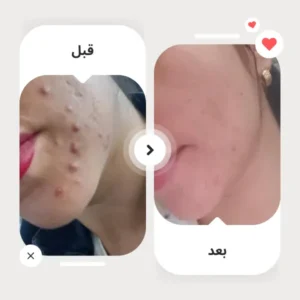 after-before-healer-beauty-customer