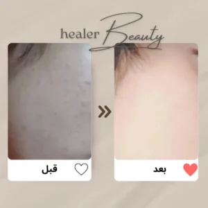 healer-beauty-chlorophyll